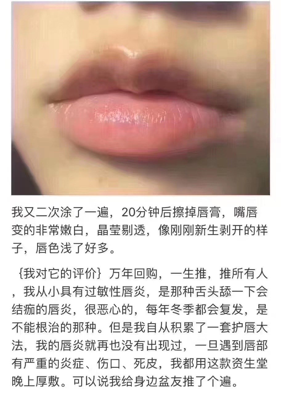 日本資生堂 MOILIP 藥用潤唇膏 (5)